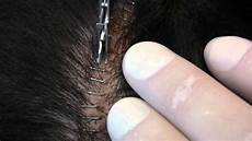 Staple Remover
