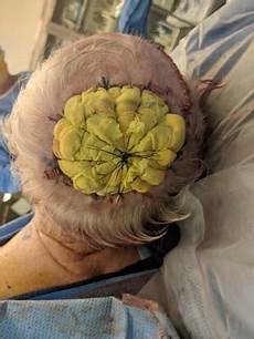 Wide Staples